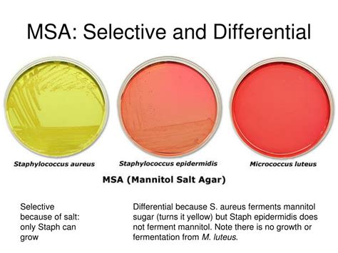 is msb agar selective or differential